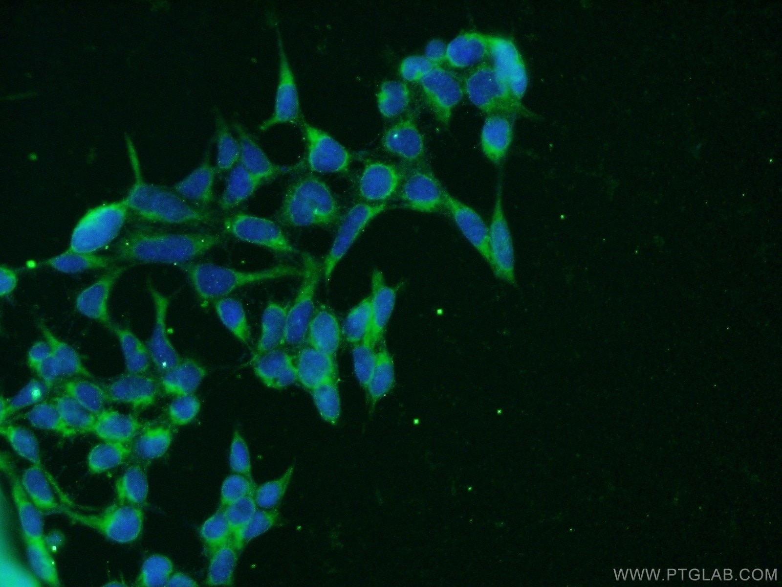 Immunofluorescence (IF) / fluorescent staining of HEK-293 cells using CLTB Polyclonal antibody (10455-1-AP)