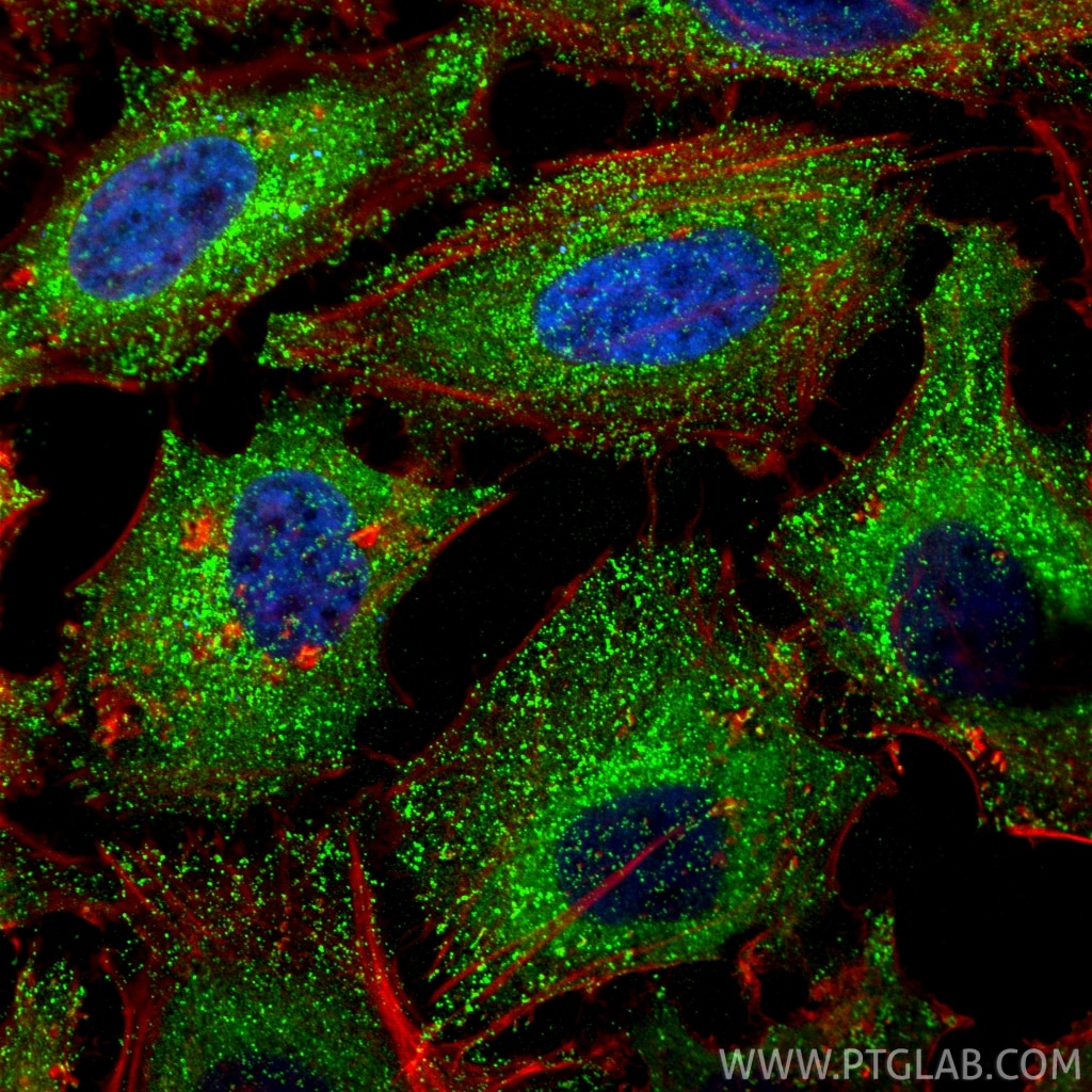 Immunofluorescence (IF) / fluorescent staining of HeLa cells using CLTB Polyclonal antibody (10455-1-AP)