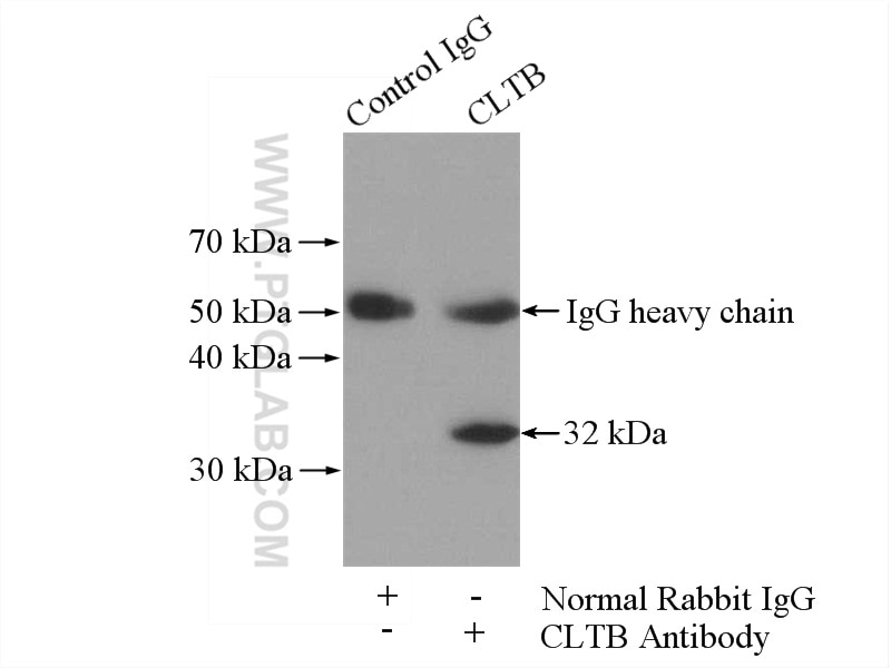 Immunoprecipitation (IP) experiment of mouse brain tissue using CLTB Polyclonal antibody (10455-1-AP)