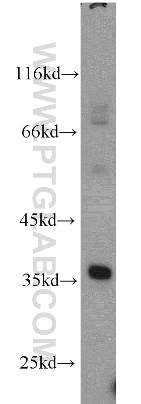 Western Blot (WB) analysis of human brain tissue using CLTB Polyclonal antibody (10455-1-AP)