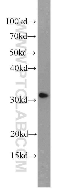 Western Blot (WB) analysis of PC-3 cells using CLTB Polyclonal antibody (10455-1-AP)