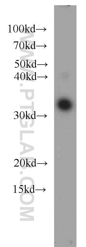 Western Blot (WB) analysis of mouse brain tissue using CLTB Polyclonal antibody (10455-1-AP)