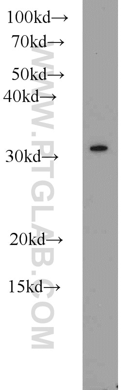 Western Blot (WB) analysis of mouse thymus tissue using CLTB Polyclonal antibody (10455-1-AP)