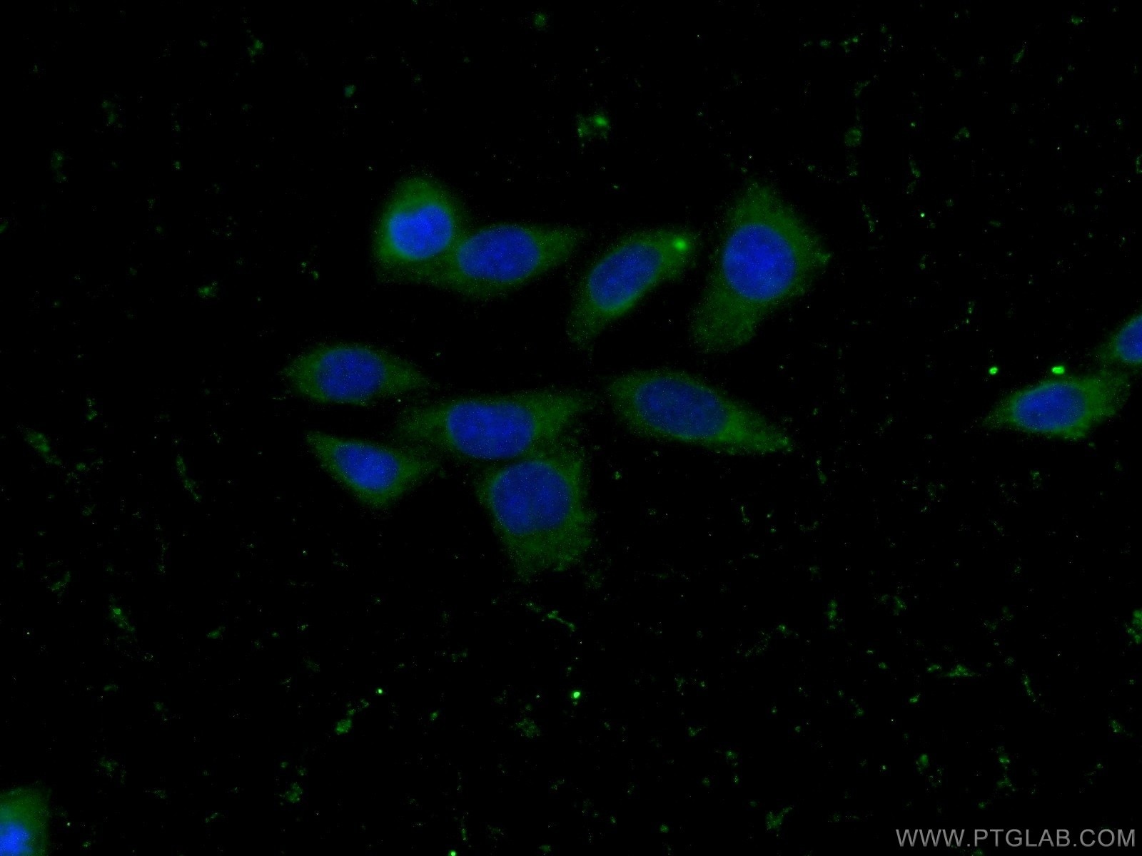 Immunofluorescence (IF) / fluorescent staining of HeLa cells using CLTB Monoclonal antibody (66270-1-Ig)