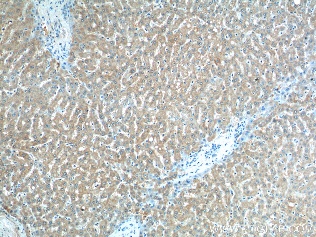 Immunohistochemistry (IHC) staining of human liver tissue using CLTB Monoclonal antibody (66270-1-Ig)