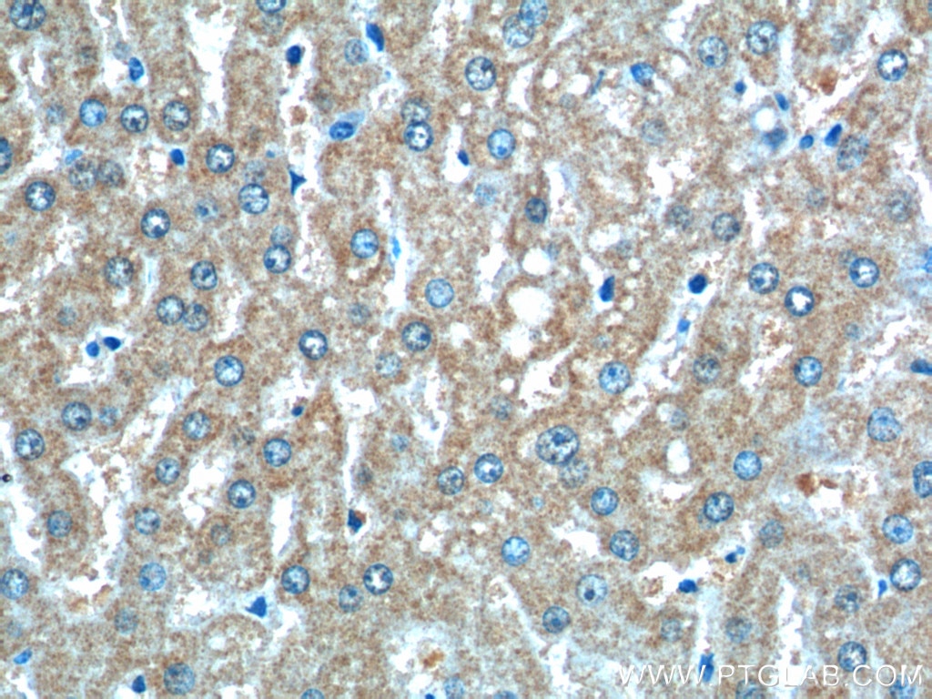 Immunohistochemistry (IHC) staining of human liver tissue using CLTB Monoclonal antibody (66270-1-Ig)