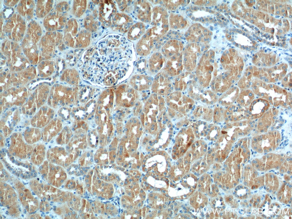 Immunohistochemistry (IHC) staining of human kidney tissue using CLTB Monoclonal antibody (66270-1-Ig)