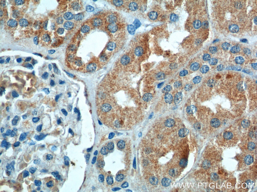 Immunohistochemistry (IHC) staining of human kidney tissue using CLTB Monoclonal antibody (66270-1-Ig)
