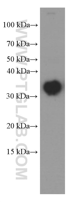 Western Blot (WB) analysis of pig brain tissue using CLTB Monoclonal antibody (66270-1-Ig)