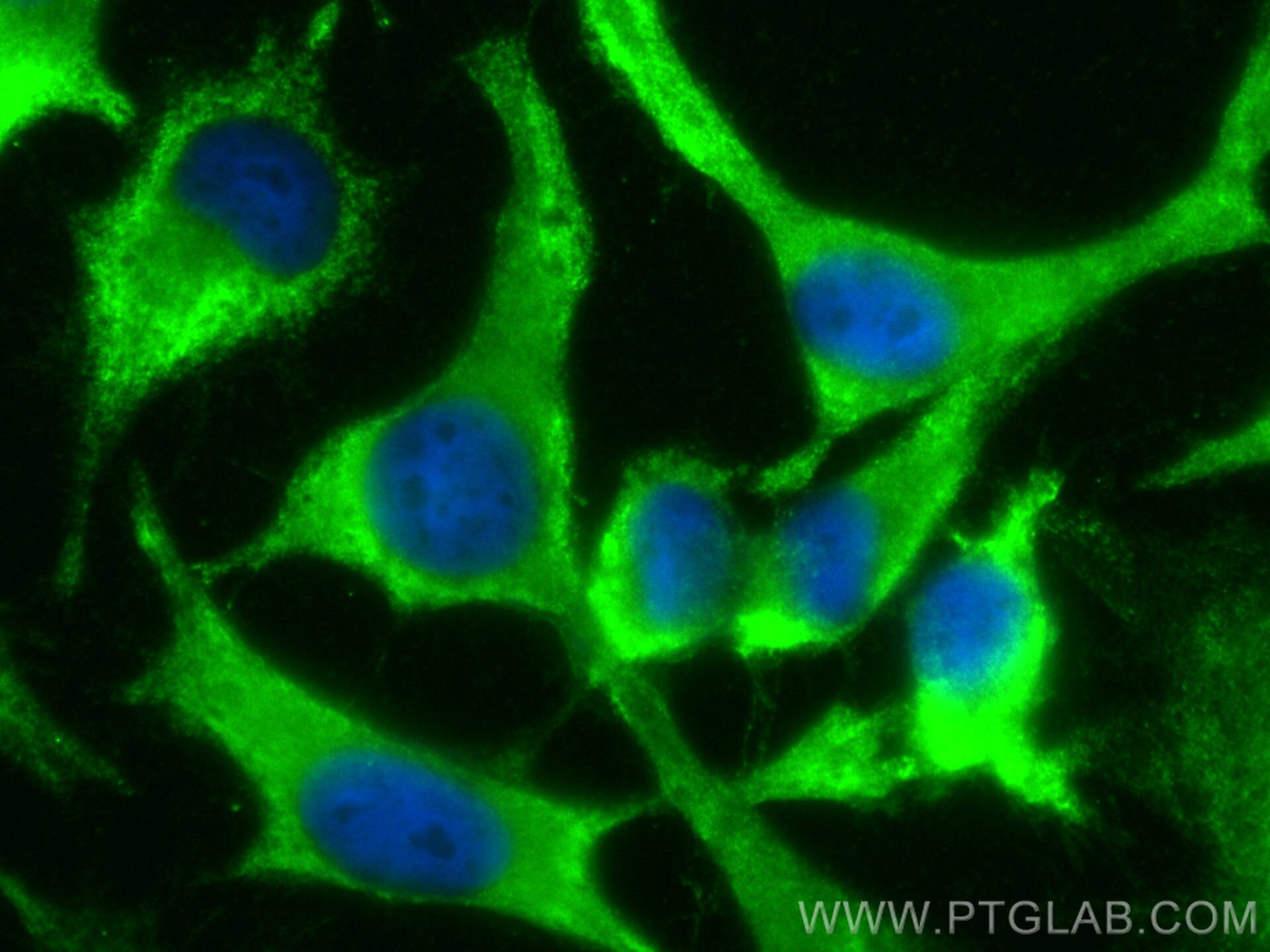 Immunofluorescence (IF) / fluorescent staining of HeLa cells using CoraLite® Plus 488-conjugated CLTB Polyclonal anti (CL488-10455)