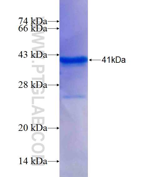 CLTB fusion protein Ag24347 SDS-PAGE