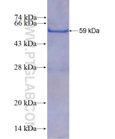 CLTB fusion protein Ag0707 SDS-PAGE