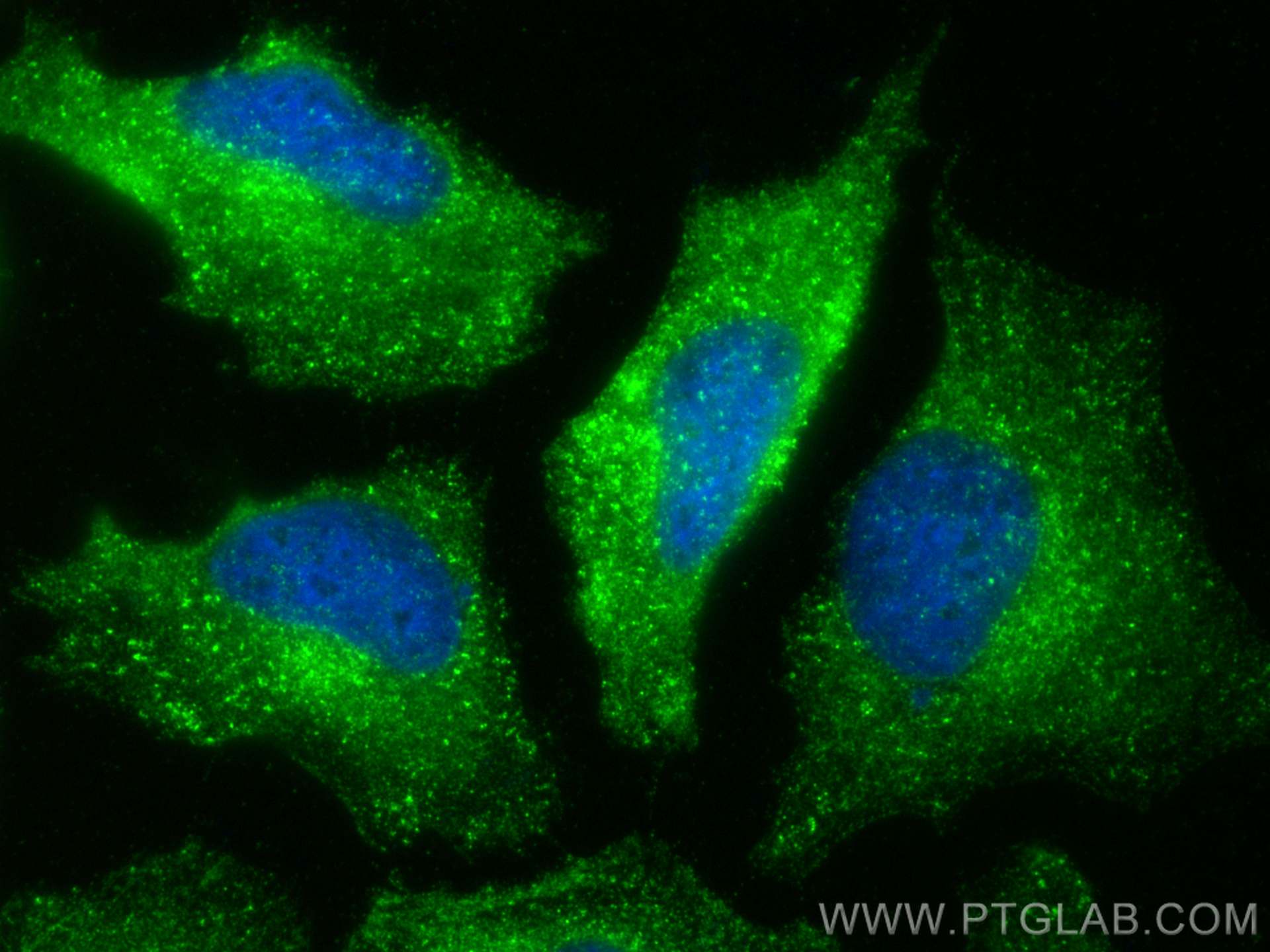 IF Staining of HeLa using 26523-1-AP