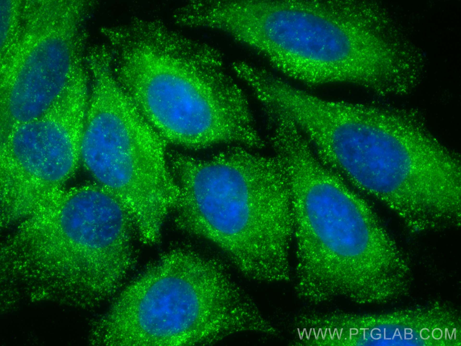 Immunofluorescence (IF) / fluorescent staining of HepG2 cells using CLTC Polyclonal antibody (26523-1-AP)