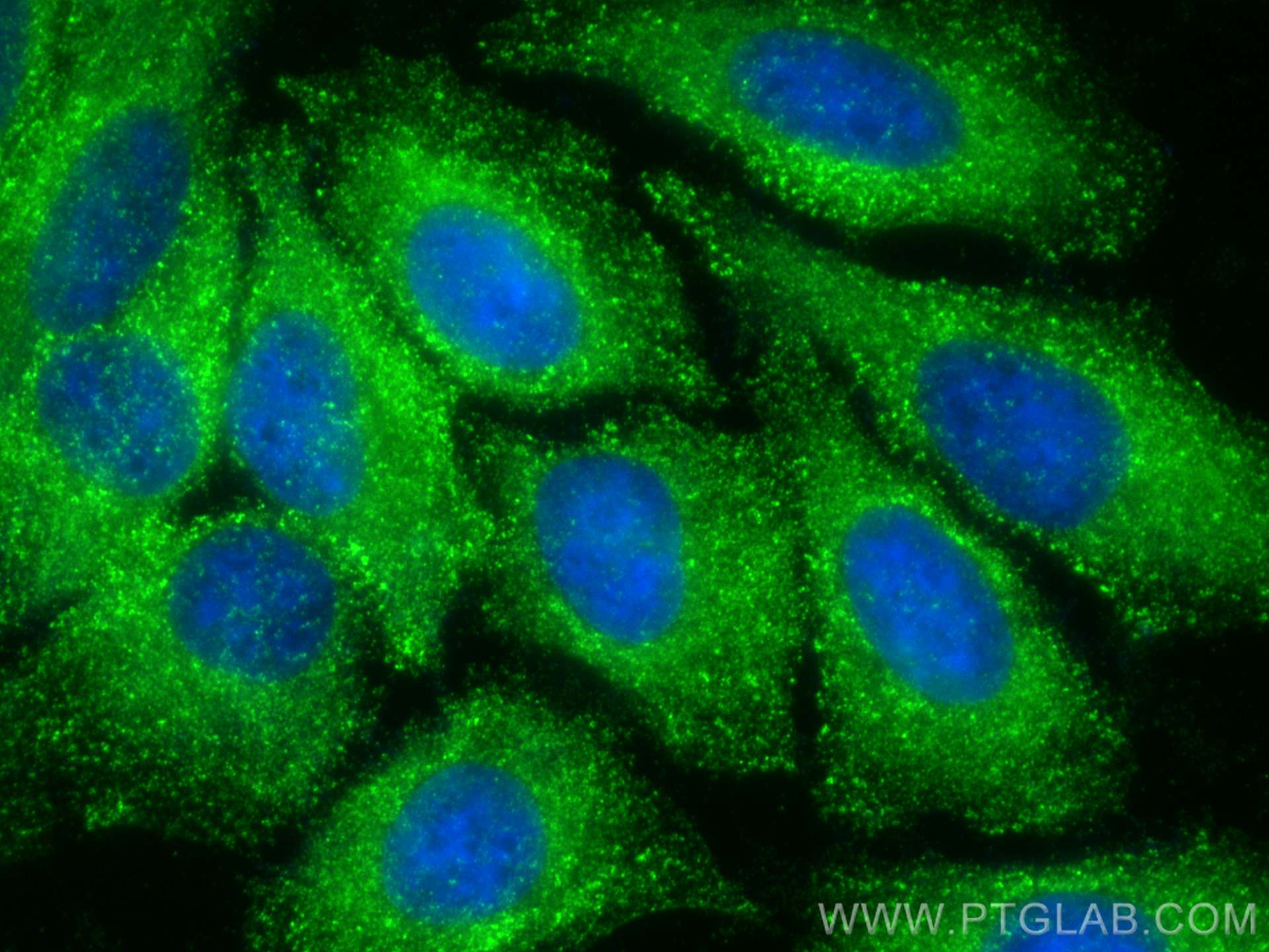 IF Staining of HepG2 using 26523-1-AP