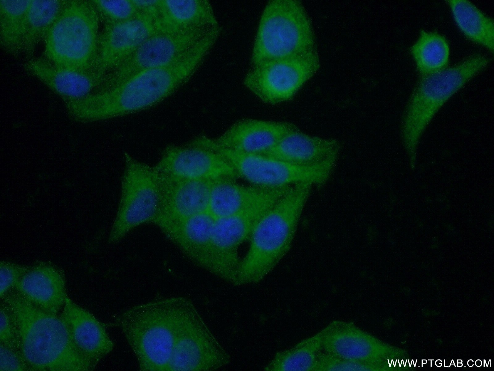 Immunofluorescence (IF) / fluorescent staining of HeLa cells using CLTC Polyclonal antibody (26523-1-AP)