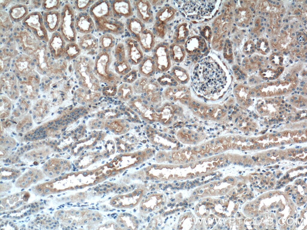 Immunohistochemistry (IHC) staining of human kidney tissue using CLTC Polyclonal antibody (26523-1-AP)