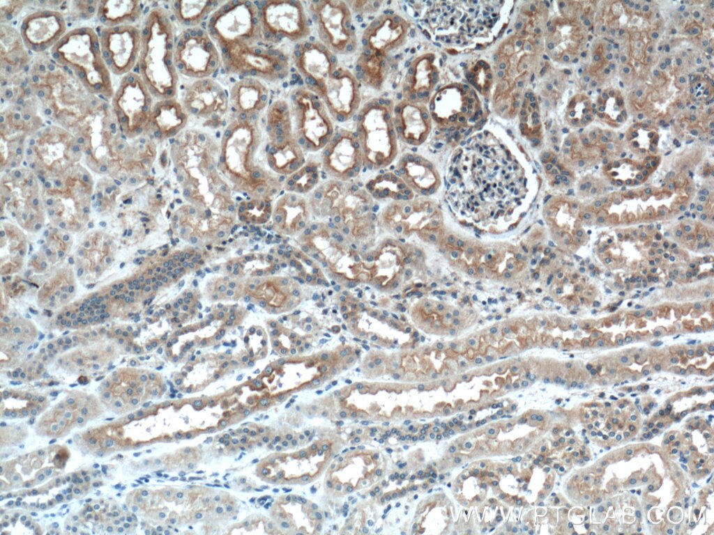 IHC staining of human kidney using 26523-1-AP