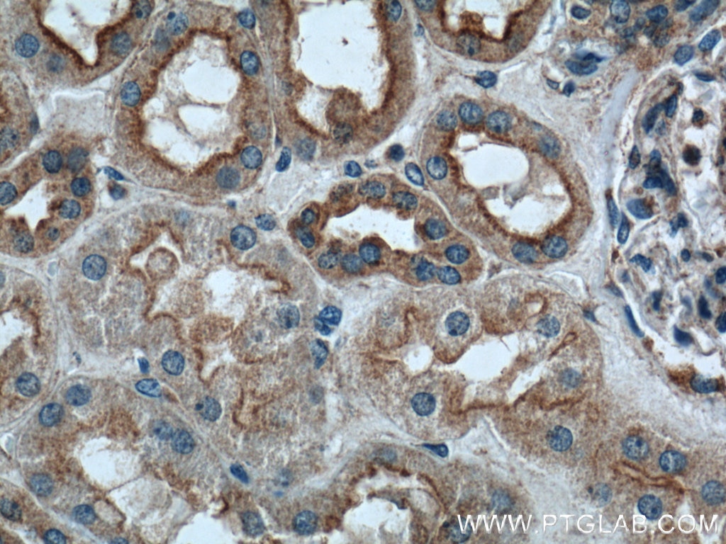 Immunohistochemistry (IHC) staining of human kidney tissue using CLTC Polyclonal antibody (26523-1-AP)