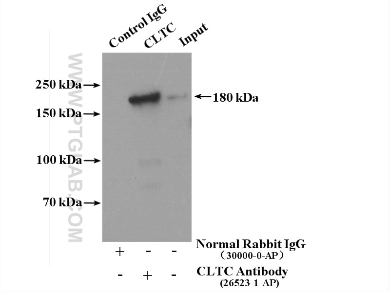 Immunoprecipitation (IP) experiment of HeLa cells using CLTC Polyclonal antibody (26523-1-AP)