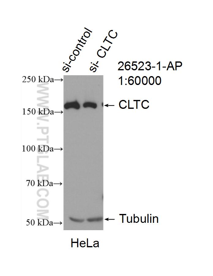 Western Blot (WB) analysis of HeLa cells using CLTC Polyclonal antibody (26523-1-AP)