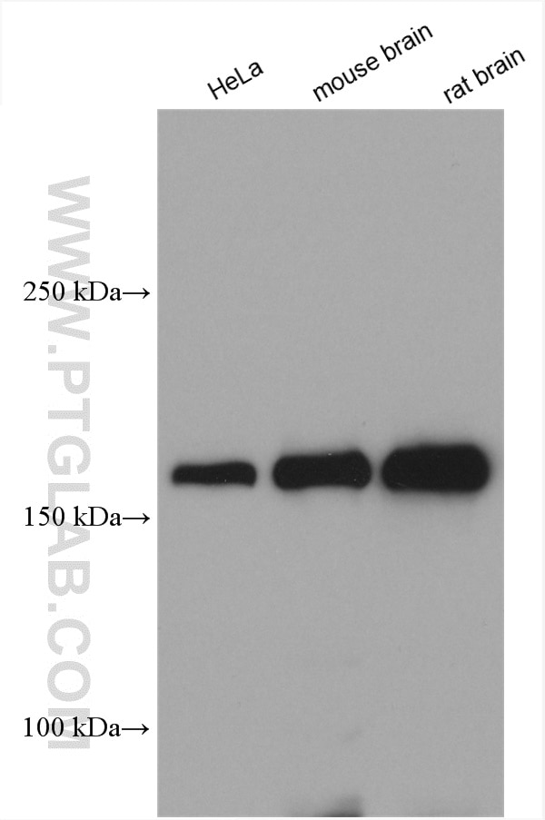 Western Blot (WB) analysis of various lysates using CLTC Polyclonal antibody (26523-1-AP)