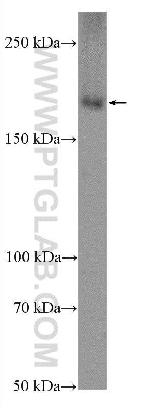 Western Blot (WB) analysis of Raji cells using CLTC Polyclonal antibody (26523-1-AP)