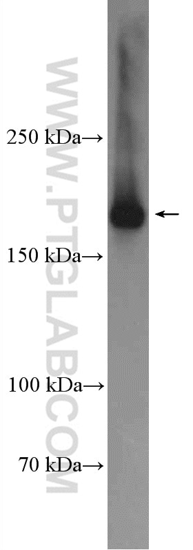 Western Blot (WB) analysis of HL-60 cells using CLTC Polyclonal antibody (26523-1-AP)