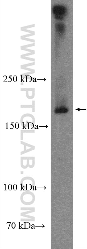 Western Blot (WB) analysis of pig brain tissue using CLTC Polyclonal antibody (26523-1-AP)