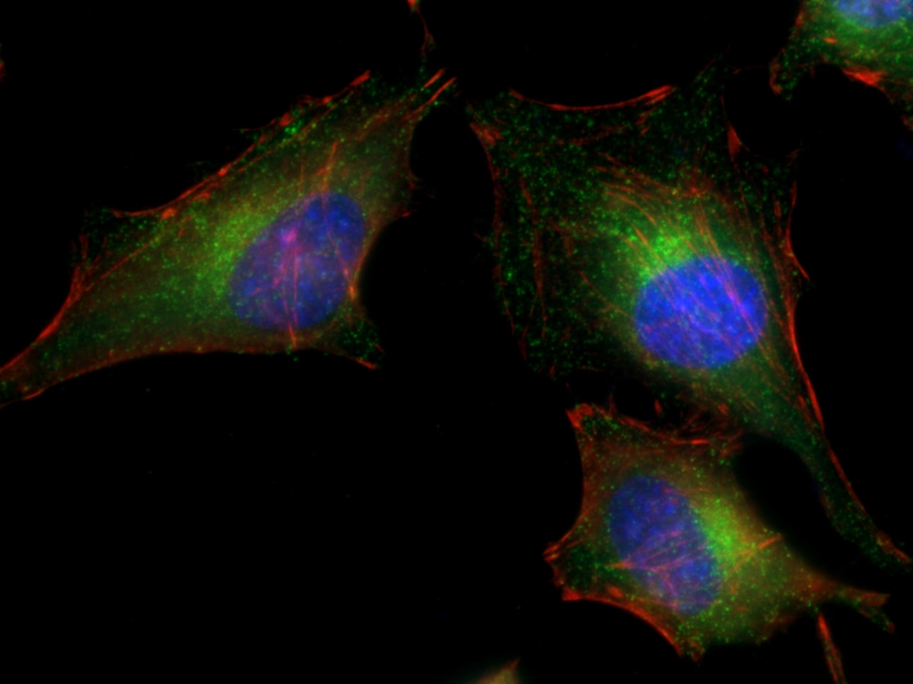 Immunofluorescence (IF) / fluorescent staining of HeLa cells using CLTC Monoclonal antibody (66487-1-Ig)