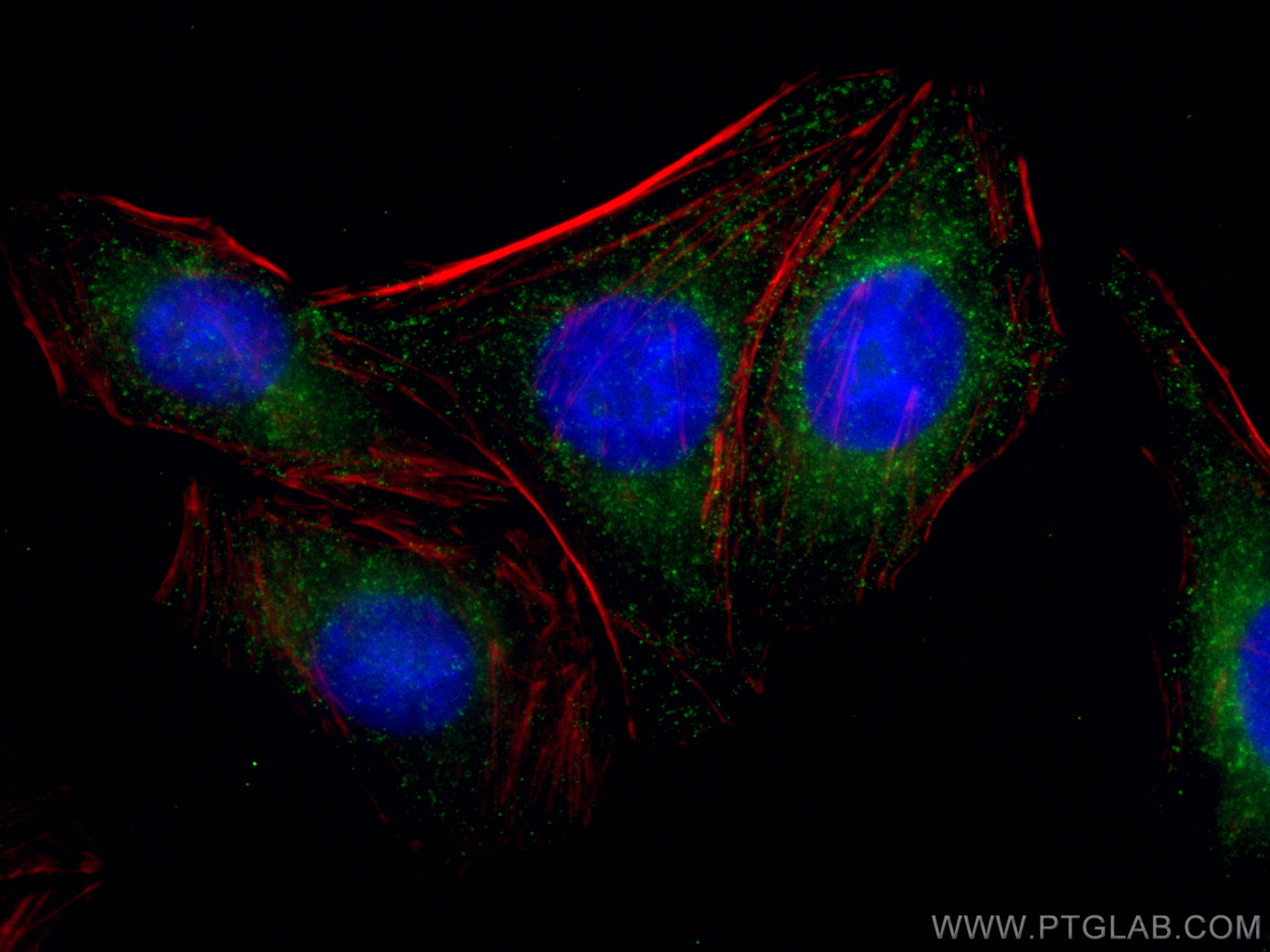 Immunofluorescence (IF) / fluorescent staining of HepG2 cells using CLTC Monoclonal antibody (66487-1-Ig)