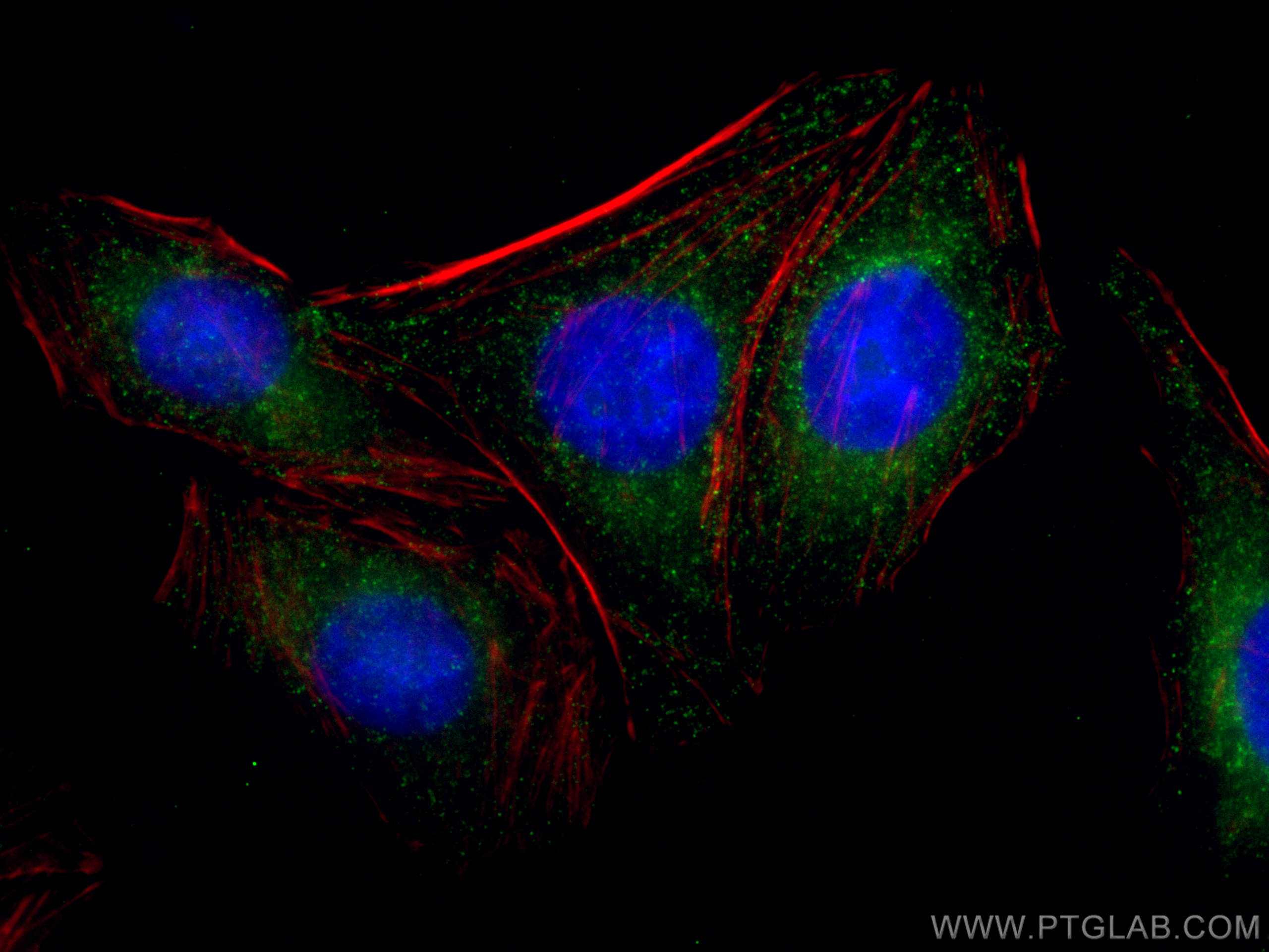 IF Staining of HepG2 using 66487-1-Ig