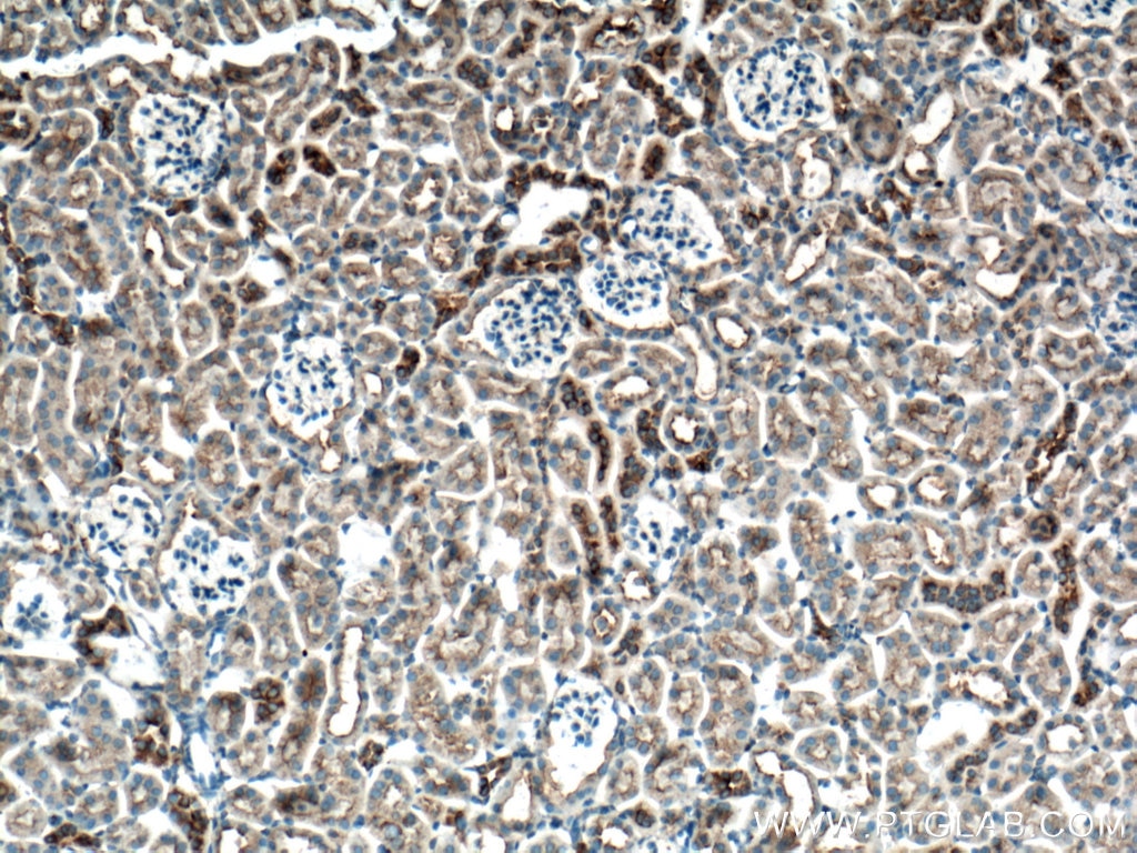 IHC staining of mouse kidney using 66487-1-Ig