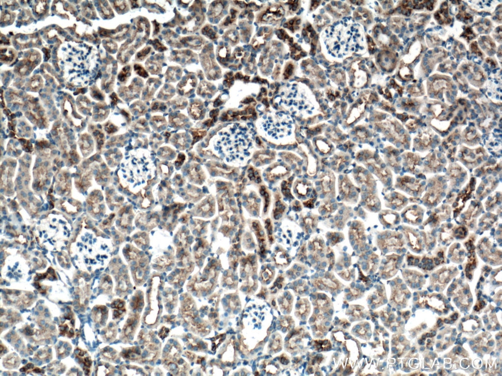 Immunohistochemistry (IHC) staining of mouse kidney tissue using CLTC Monoclonal antibody (66487-1-Ig)