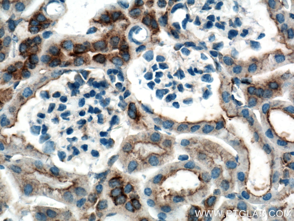 Immunohistochemistry (IHC) staining of mouse kidney tissue using CLTC Monoclonal antibody (66487-1-Ig)