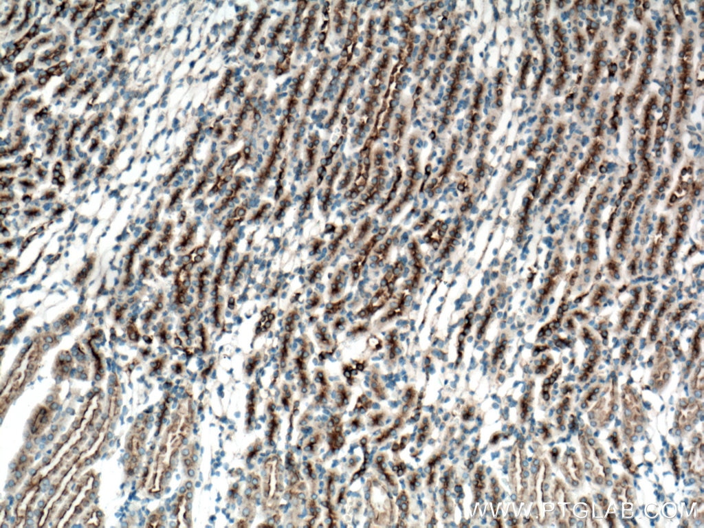 Immunohistochemistry (IHC) staining of mouse kidney tissue using CLTC Monoclonal antibody (66487-1-Ig)