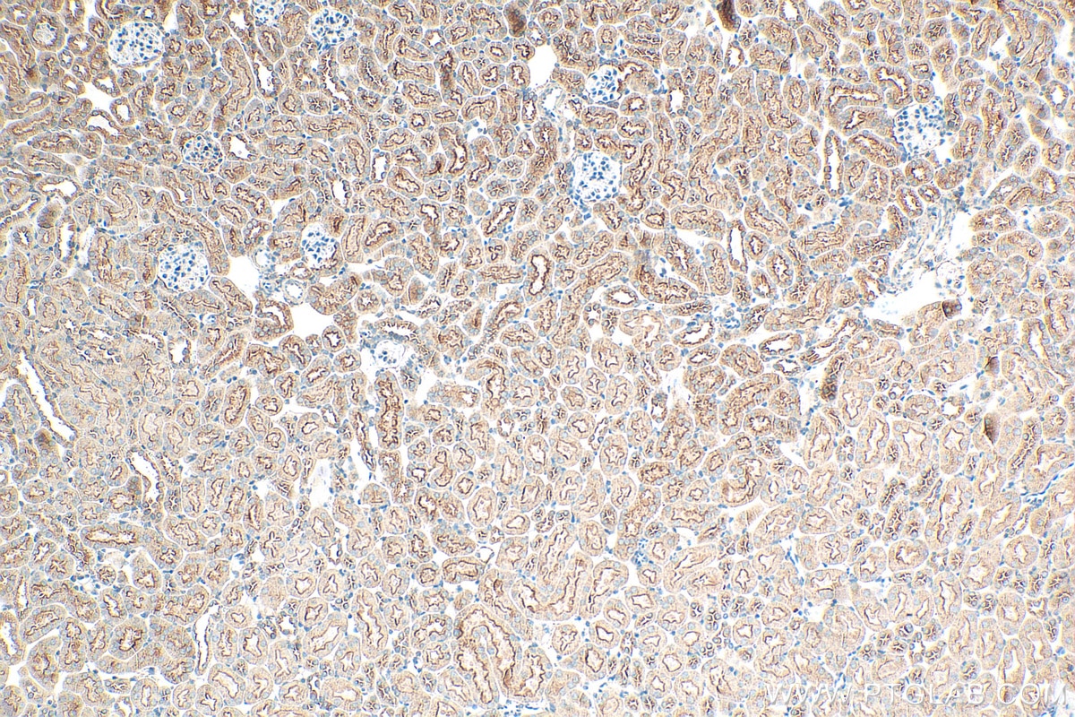 Immunohistochemistry (IHC) staining of mouse kidney tissue using CLTC Monoclonal antibody (66487-1-Ig)