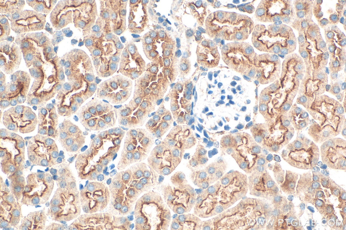 Immunohistochemistry (IHC) staining of mouse kidney tissue using CLTC Monoclonal antibody (66487-1-Ig)