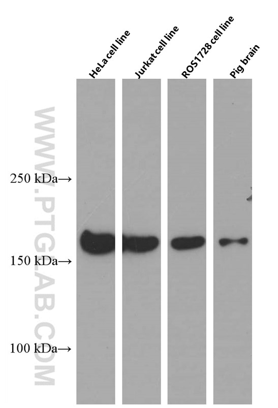 Western Blot (WB) analysis of HeLa cells using CLTC Monoclonal antibody (66487-1-Ig)