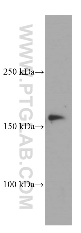 Western Blot (WB) analysis of Raji cells using CLTC Monoclonal antibody (66487-1-Ig)