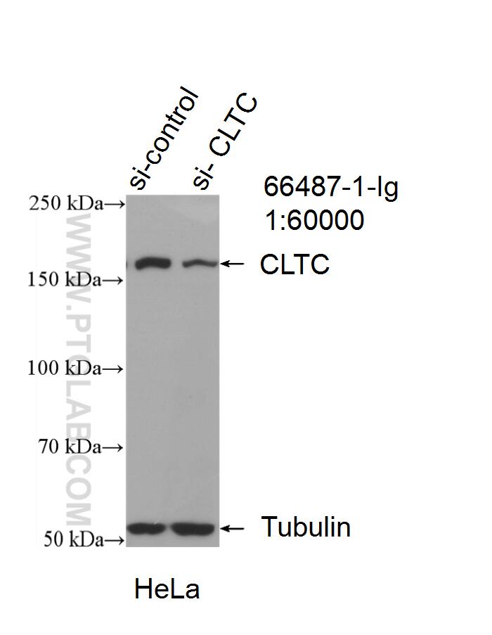 Western Blot (WB) analysis of HeLa cells using CLTC Monoclonal antibody (66487-1-Ig)