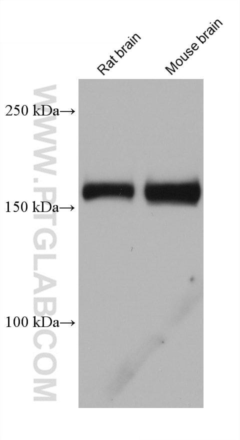 Western Blot (WB) analysis of various lysates using CLTC Monoclonal antibody (66487-1-Ig)