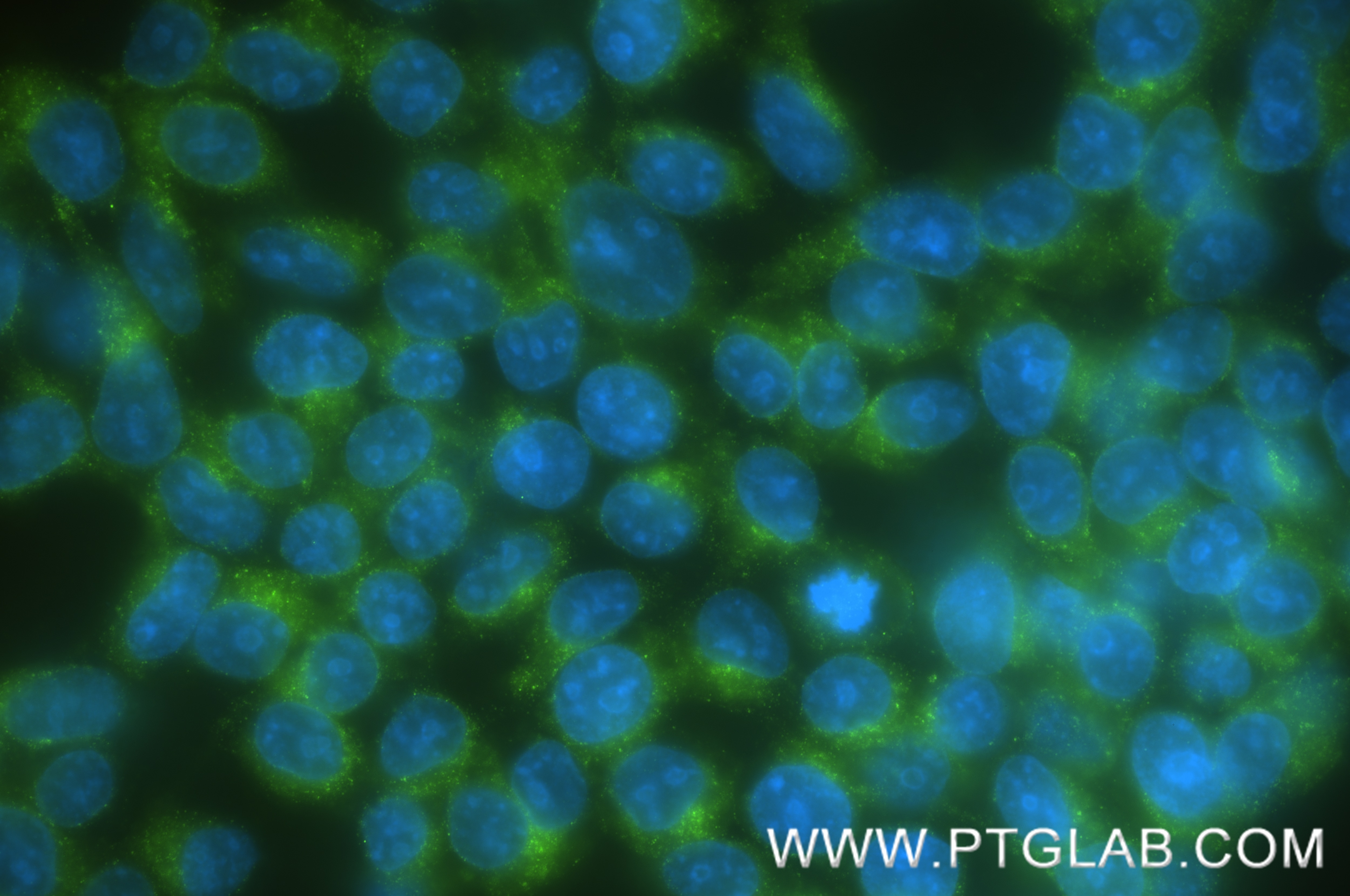 IF Staining of HEK-293 using 86660-3-RR Immunofluorescence (IF) / fluorescent staining of HEK-293 cells using CLTC Recombinant monoclonal antibody (86660-3-RR)