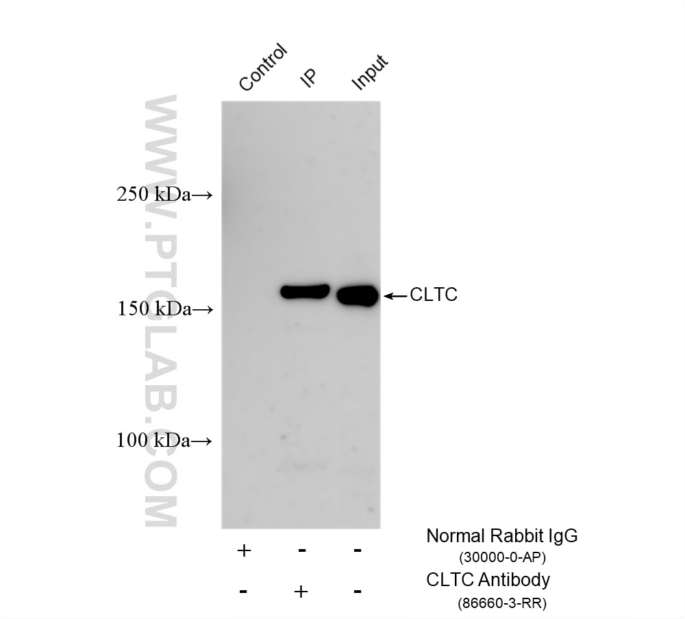 IP experiment of HEK-293 using 86660-3-RR Immunoprecipitation (IP) experiment of HEK-293 cells using CLTC Recombinant monoclonal antibody (86660-3-RR)