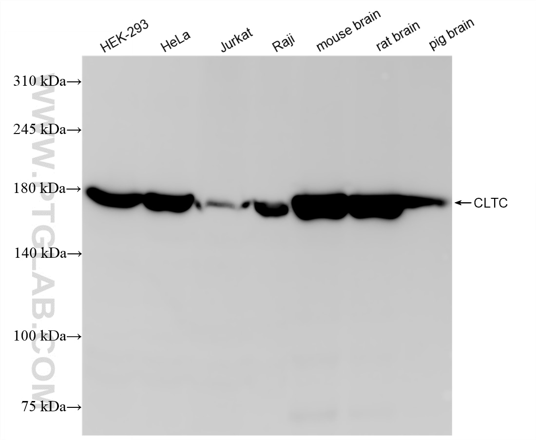 WB analysis using 86660-3-RR Western Blot (WB) analysis of various lysates using CLTC Recombinant monoclonal antibody (86660-3-RR)