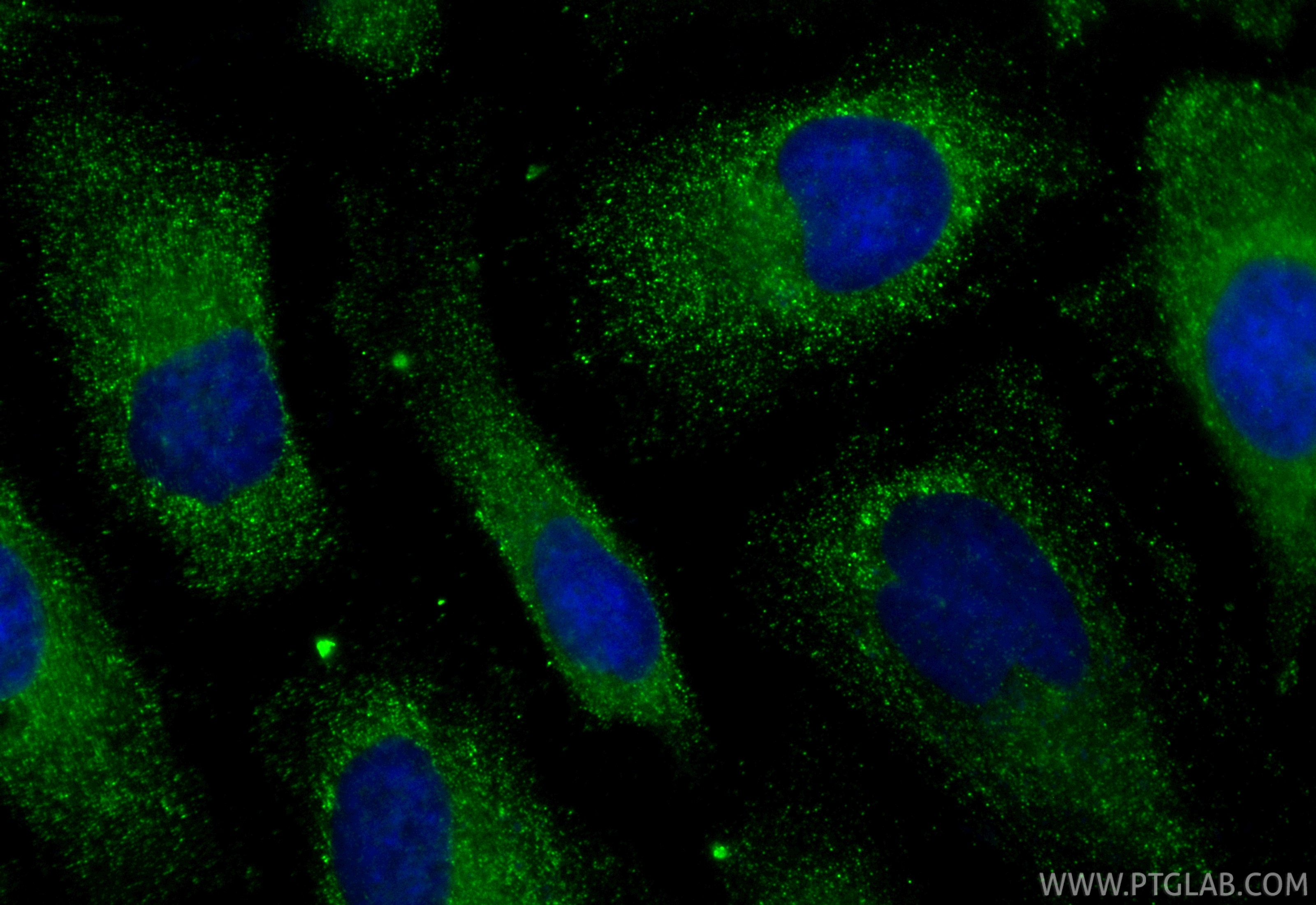 Immunofluorescence (IF) / fluorescent staining of HeLa cells using CoraLite® Plus 488-conjugated CLTC Monoclonal anti (CL488-66487)