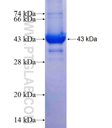 CLTC fusion protein Ag25040 SDS-PAGE