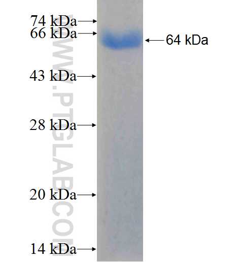 CLTC fusion protein Ag25041 SDS-PAGE