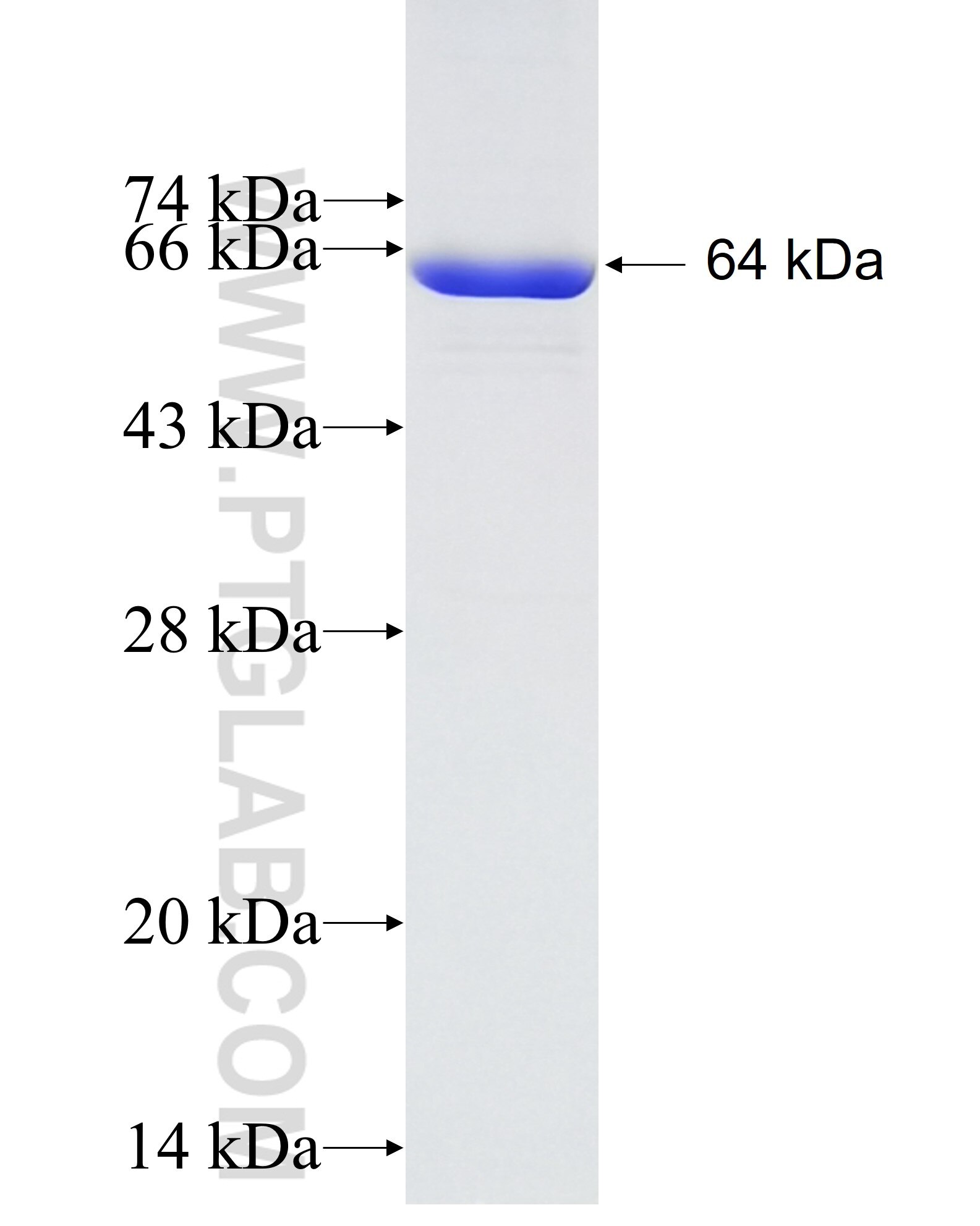 CLTC fusion protein Ag25041 SDS-PAGE