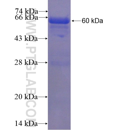CLTC fusion protein Ag5470 SDS-PAGE